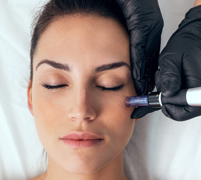 microneedling-woman-receiving-micronnedling-treatment